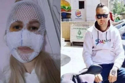 Eski sevgilisinin yüzüne kimyasal madde atan sanığa verilen ceza onandı