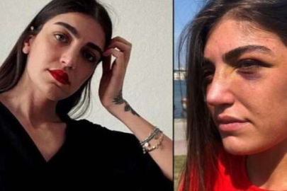 Manken Gizem Akbaş'ı darp eden sanığa hapis cezası