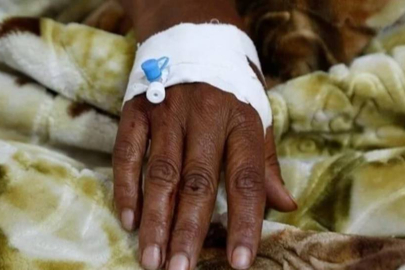 Güney Afrika'da kolera salgınında 10 kişi hayatını kaybetti