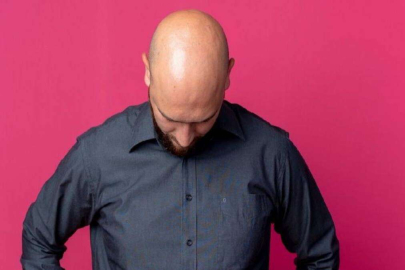 Ülkelerin saç haritası çıkarıldı:  En çok kel hangi ülkede?
