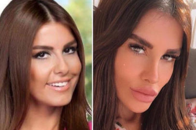 Tuğçe Özbudak kısmi felç geçirdi