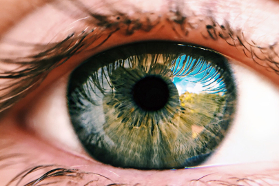 “Göz tansiyonu olarak bilinen glokom çok sinsi bir göz hastalığıdır”