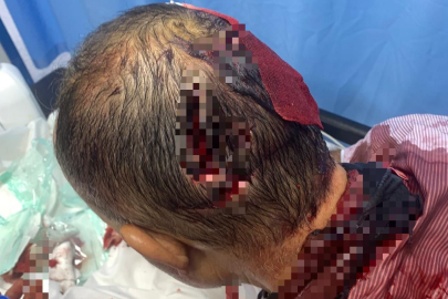 Bir köpek dehşeti de Bursa'dan...