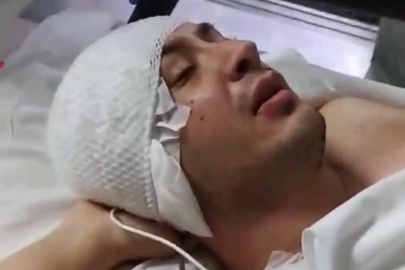 Adliye saldırısında vurulan uzman çavuş hayata tutundu