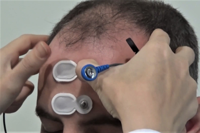 Gemlik Devlet Hastanesinde işitme hastaları için BERA testi