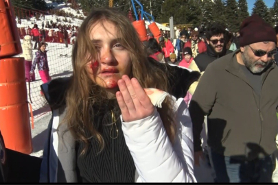 Uludağ'da feci kaza! 3 yaralı