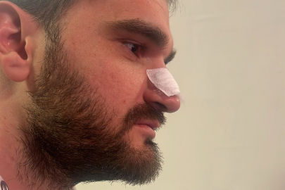 Bursa Süper Amatör Lig’inde kavga çıktı