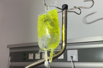 ‘Sarı serum’ uyarısı