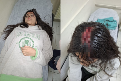 Genç kızın başına buz kütlesi düştü