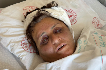 Yufka yüzünden gelini tarafından tuğlayla dövülüp komalık olmuştu, günler sonra uyandı