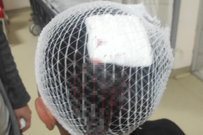 Şampiyonluk kutlamasında havai fişek 9 yaşındaki çocuğun kafasına isabet etti