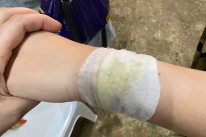 Hıdırellez şenliklerinde meşale 4 çocuğu yaktı!