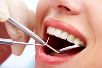 Ağız kokusu kader değildir