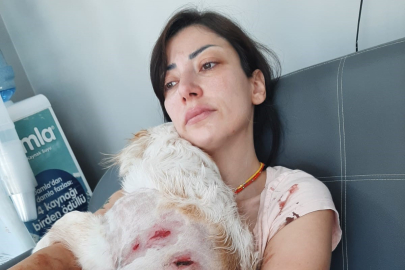 Genç kadın ve gezdirmeye çıkardığı köpeği dehşeti yaşadı