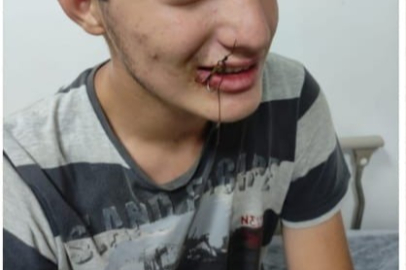 Bu kez oltaya çocuk takıldı