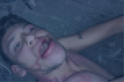 "Böcek yedirip dişlerimi kırdılar" iddiasına 20 yıl hapis talebi