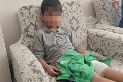 Okula giderken sokak köpeğinin saldırısına uğradı