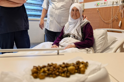 77 yaşındaki kadının safra kesesinden 213 taş çıkarıldı