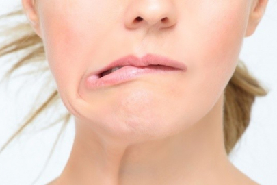 Geçici felç ciddiye alınmalı