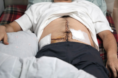 İstanbul'da dehşet: Kavgayı ayırmak isteyen genç 6 yerinden bıçaklandı, aile tehdit edildi