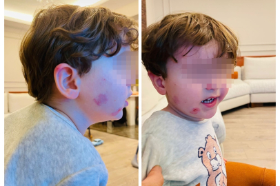 Bursa'da kreş skandalı: 2,5 yaşındaki çocuk darp edildi