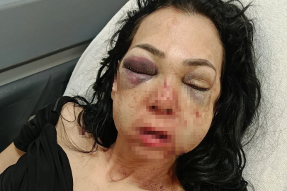 Anne ve oğluna darp davasında ilginç savunma: "Merdivenden düştü"