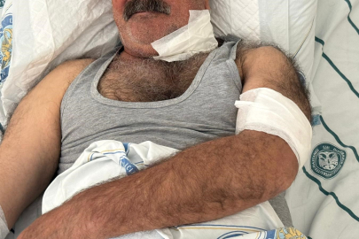 At sahibini boğazından ısırarak ağır yaraladı