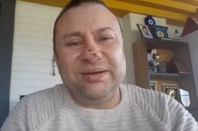 Ünlü Şarkıcı Onur Akay ölümden döndü: Pitbull saldırdı!