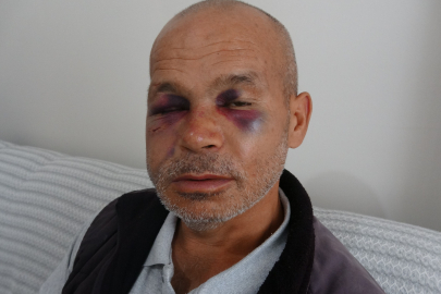Engelli adamı darbeden şüpheli serbest bırakıldı