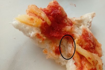 9 yaşındaki çocuğun yediği ekmekten çatal iğne çıktı