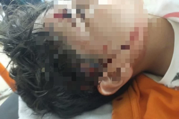 Bursa'da dehşet! 10 yaşındaki çocuğa 8 köpek saldırdı
